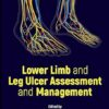Lower Limb and Leg Ulcer Assessment and Management (English Edition) -Original PDF