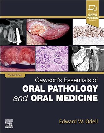 Cawson's Essentials of Oral Pathology and Oral Medicine 10th Edition-Original PDF