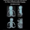 Fetal and Perinatal Skeletal Dysplasias: An Atlas of Multimodality Imaging 2nd Edition-Original PDF