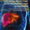 Safe Major Hepatectomy after Preoperative Liver Regeneration: Preopearative PVE, Two-Satage Hepatetomy, ALPPS and Hepatic Vein Deprivation -Original PDF