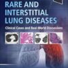 Rare and Interstitial Lung Diseases: Clinical Cases and Real-World Discussions -EPUB