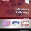 Pulmonary Pathology (Foundations in Diagnostic Pathology) 3rd Edition-True PDF