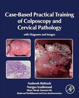 Case-Based Practical Training of Colposcopy and Cervical Pathology: With Diagrams and Images -Original PDF