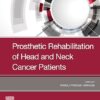 Prosthetic Rehabilitation of Head Neck Cancer -True PDF