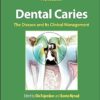 Dental Caries: The Disease and its Clinical Management 4th Edition-Original PDF