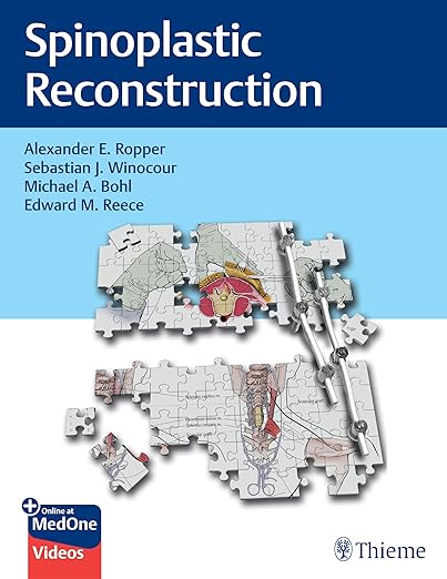 Spinoplastic Reconstruction -Original PDF