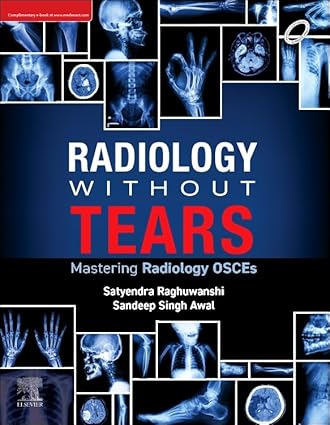 Radiology without tears: mastering radiology osces, Special Edition-Original PDF