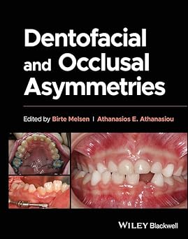 Dentofacial and Occlusal Asymmetries -EPUB