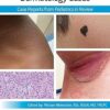 Pediatric Collections: Dermatology Cases: Case Reports from Pediatrics in Review -Original PDF