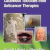 Cutaneous Toxicities from Anticancer Therapies -EPUB