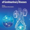 Genetics and Epigenetics of Genitourinary Diseases -EPUB