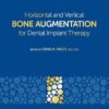 Horizontal and Vertical Bone Augmentation for Dental Implant Therapy -Original PDF