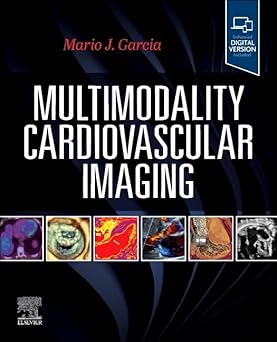 Multimodality Cardiovascular Imaging -True PDF