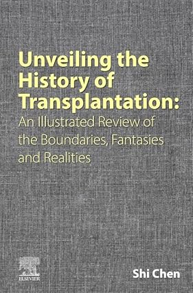 Unveiling the History of Transplantation: An Illustrated Review of the Boundaries, Fantasies and Realities -EPUB