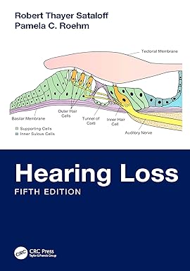 Hearing Loss 5th Edition-EPUB