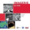 Imagerie du foie (French Edition) -Original PDF