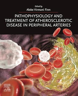 Pathophysiology and Treatment of Atherosclerotic Disease in Peripheral Arteries -EPUB