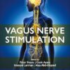 Vagus Nerve Stimulation -EPUB