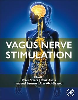 Vagus Nerve Stimulation -EPUB