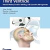 Colloid Cysts of the Third Ventricle: Natural History, Decision-Making, and Operative Management -Original PDF