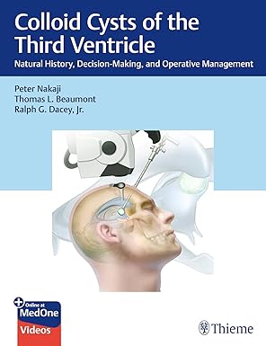 Colloid Cysts of the Third Ventricle: Natural History, Decision-Making, and Operative Management -Original PDF