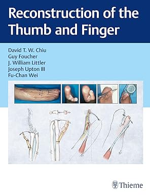 Reconstruction of the Thumb and Finger -Original PDF