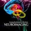 Neuroimaging: Sensing Biochemistry in the Brain -Original PDF