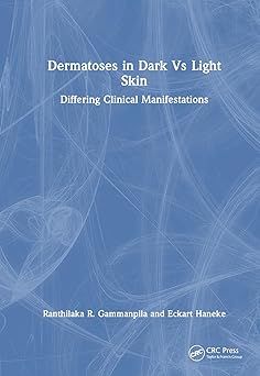 Dermatoses in Dark Vs Light Skin: Differing Clinical Manifestations -EPUB