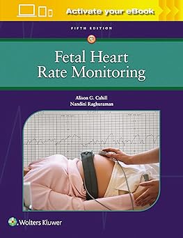 Fetal Heart Rate Monitoring 5th Edition-EPUB