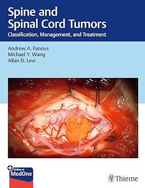 Spine and Spinal Cord Tumors: Classification, Management, and Treatment -Original PDF