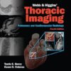 Webb & Higgins Thoracic Imaging 4th Edition-EPUB