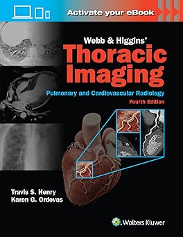 Webb & Higgins Thoracic Imaging 4th Edition-EPUB