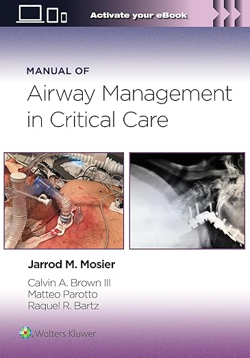 Manual of Airway Management in Critical Care-EPUB