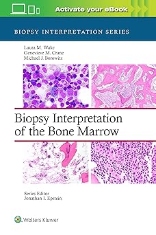 Biopsy Interpretation of the Bone Marrow (Biopsy Interpretation Series) -EPUB