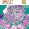 Diagnostic Pathology: Breast 4th Edition-Original PDF