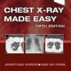Chest X-Ray Made Easy 5th Edition-EPUB