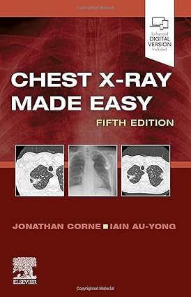 Chest X-Ray Made Easy 5th Edition-EPUB