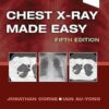 Chest X-Ray Made Easy 5th Edition-EPUB