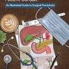 Visual Aid for Perioperative Patient Consult: An Illustrated Guide to Surgical Procedures -EPUB