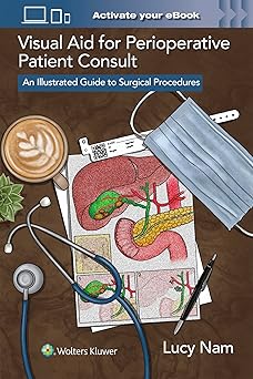 Visual Aid for Perioperative Patient Consult: An Illustrated Guide to Surgical Procedures -EPUB