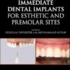 Immediate Dental Implants for Esthetic and Premolar Sites -EPUB