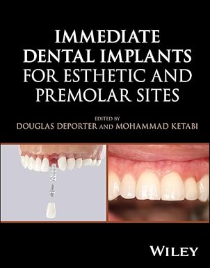 Immediate Dental Implants for Esthetic and Premolar Sites -EPUB