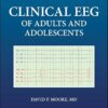 Clinical EEG of Adults and Adolescents -EPUB