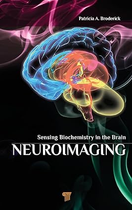 Neuroimaging: Sensing Biochemistry in the Brain -EPUB