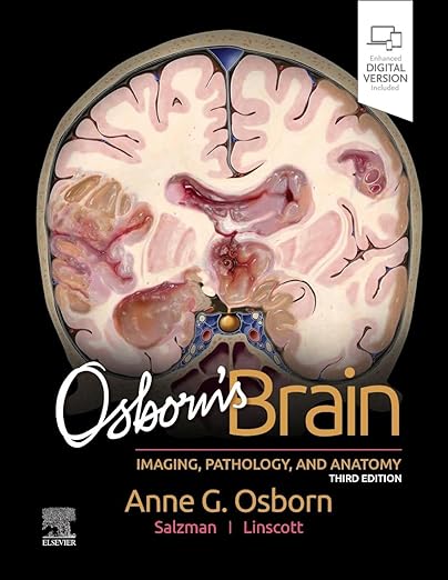 Osborn's Brain 3rd edition-EPUB