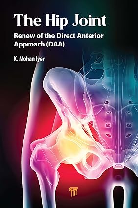 The Hip Joint: Renew of the Direct Anterior Approach (DAA) -EPUB