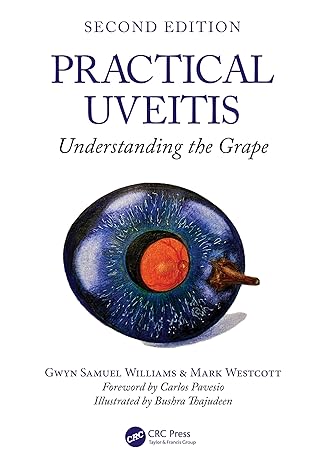 Practical Uveitis: Understanding the Grape 2nd Edition-Original PDF