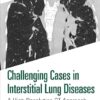 Challenging Cases in Interstitial Lung Diseases: A High-Resolution CT Approach -Original PDF