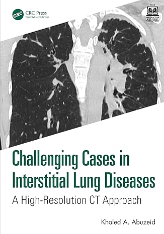 Challenging Cases in Interstitial Lung Diseases: A High-Resolution CT Approach -EPUB