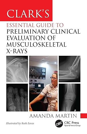 Clark’s Essential Guide to Preliminary Clinical Evaluation of Musculoskeletal X-rays: Evaluating and Commenting on Images (Clark's Companion Essential Guides) -Original PDF